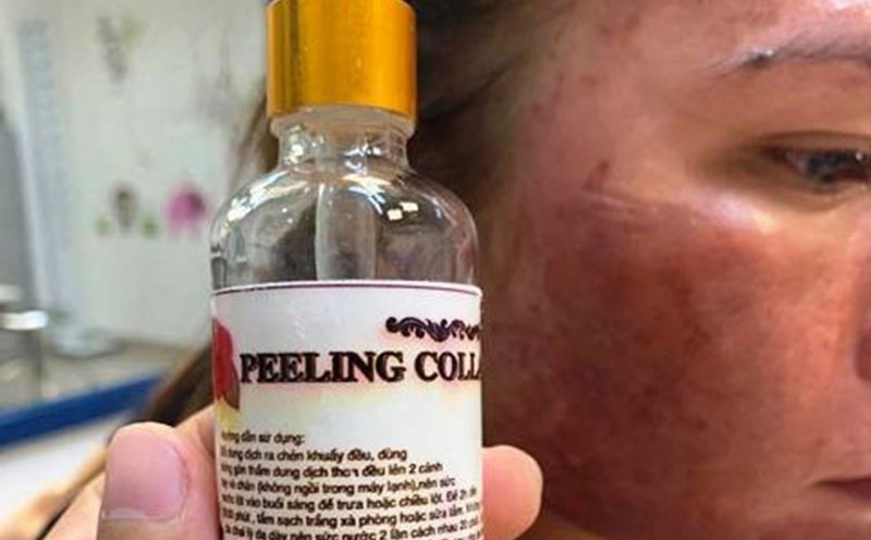 The patient has a happenstance cosmetic allergy and must be treated at the Central Dermatology Hospital. Photo: Provided by the Central Dermatology Hospital