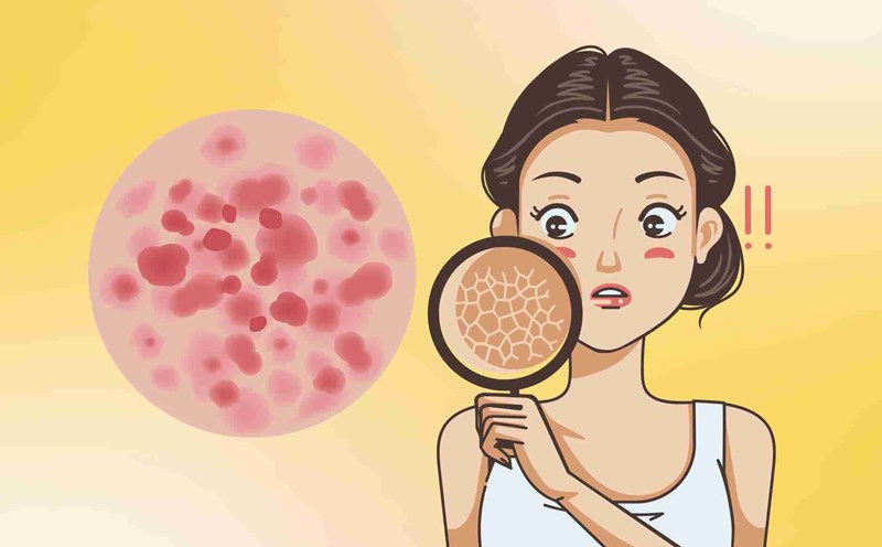 6 mistakes that cause severe skin damage in the summer that many people make