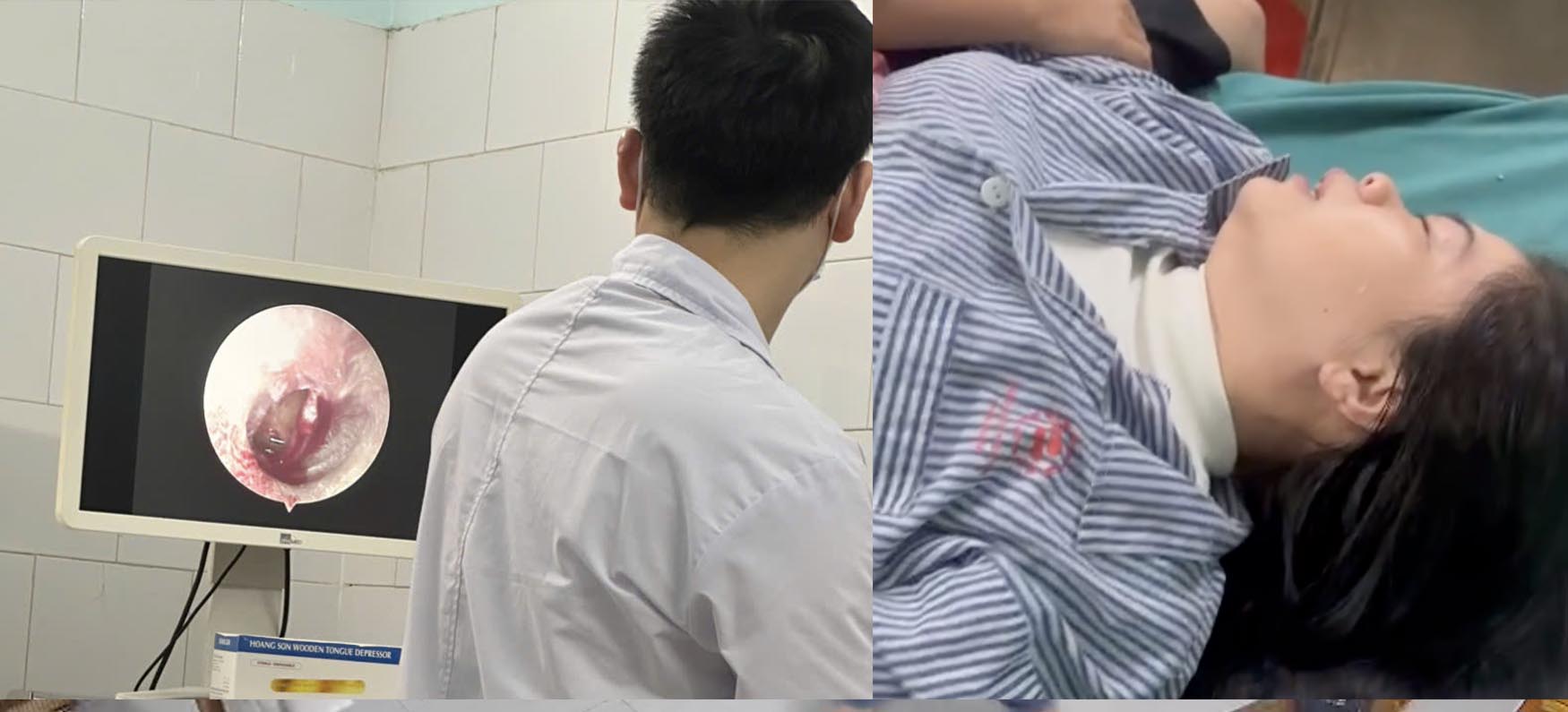Chi M. hien dang dieu tri tai benh vien trong trang thai hoang loan, nhieu ton thuong vung dau. Anh: Nguoi nha nan nhan cung cap.