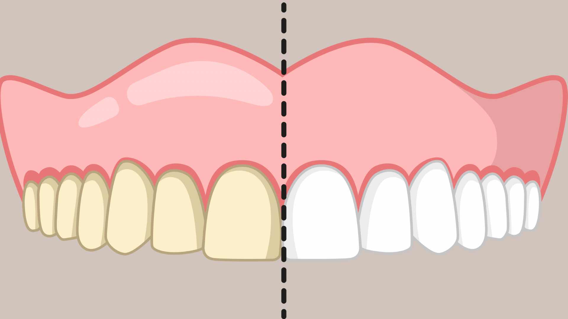 Puedes blanquear tus dientes con algunos ingredientes naturales y seguros. Imagen de la imagen: