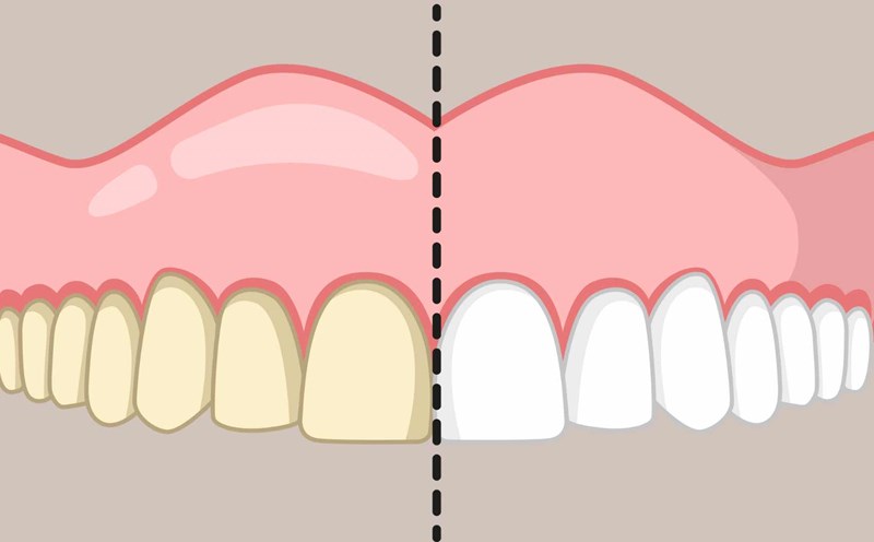You can whiten your teeth with some natural, safe ingredients. Graphic photo: Hoang Loc