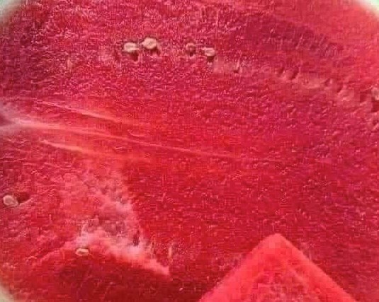 Thời điểm vàng ăn dưa hấu hạ axit uric