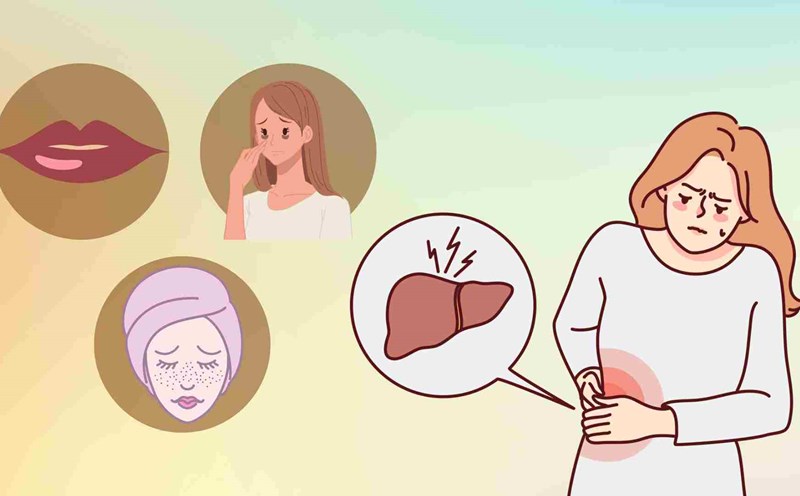 Poor liver detoxification if face shows this sign