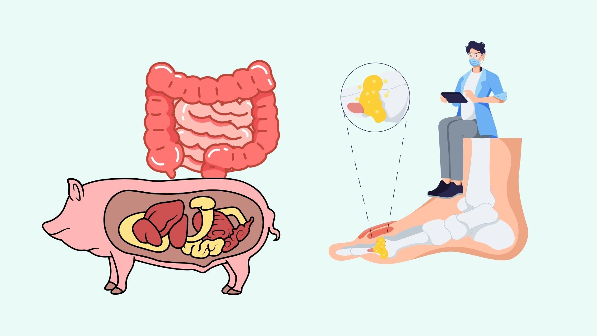 La fiebre del cerdo puede aumentar el acido urico en el cuerpo. Diseñado por Linh Dan