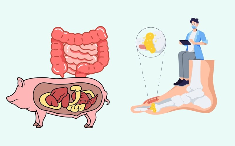 Pork can silently increase uric acid in the body. Graphics: Linh Dan
