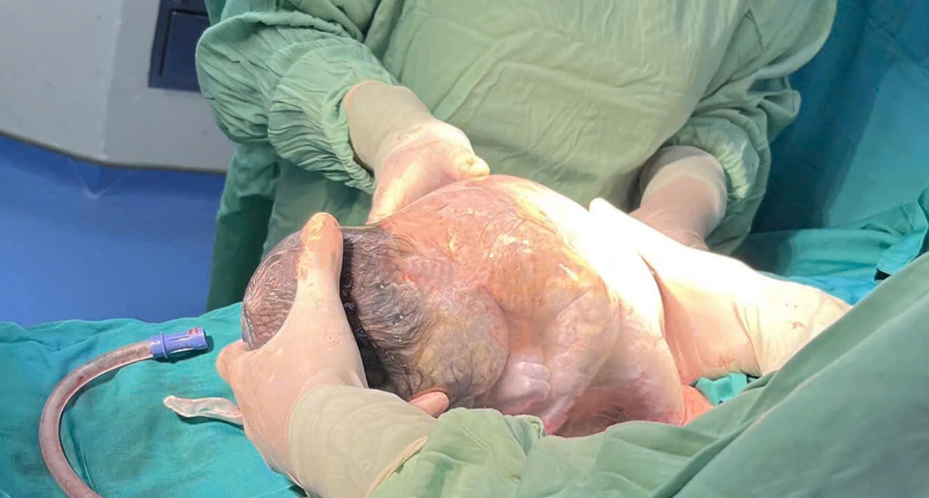 La niña nacio en estado intacto en el Hospital de la Universidad de Michigan. Foto: Hospitales que lo proveen