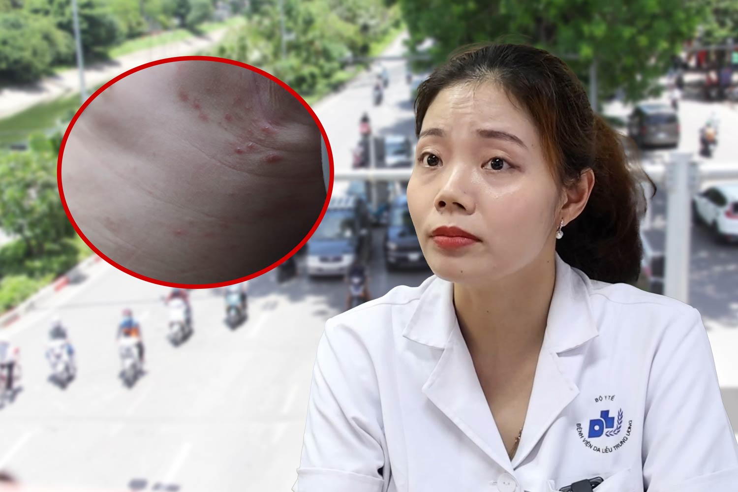 Doctor names common skin diseases in hot weather