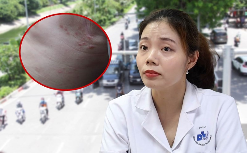 Doctor names common skin diseases in hot weather