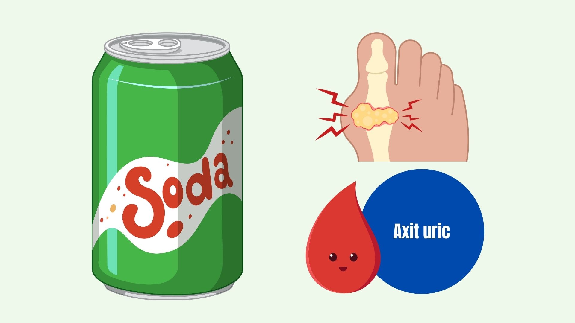 Drinking alkaline soda every day can significantly reduce uric acid. Graphics: Linh Dan
