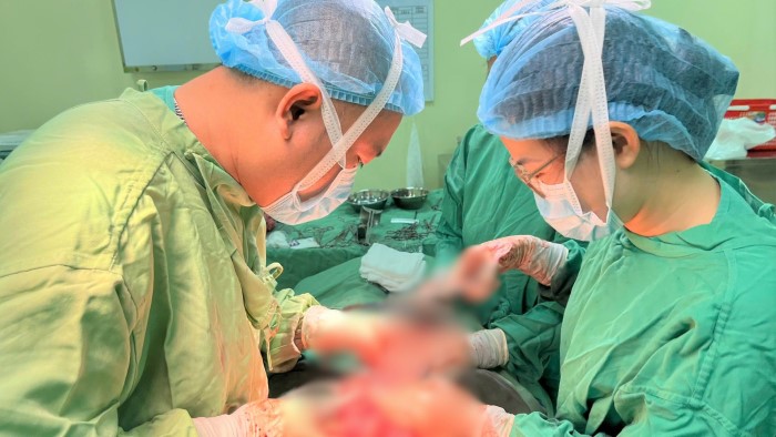 Bac si Truong Quoc Viet va cong su phau thuat cat bo khoi u xo nang 3kg cho nu benh nhan 36 tuoi. Anh: Song Han