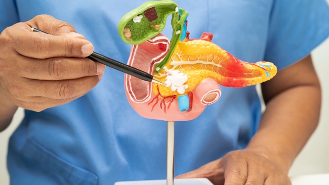 Golden skin and yellow eyes are obvious manifestations of increased liver enzymes. Illustrative photo: Thu Duc Hospital, Ho Chi Minh City