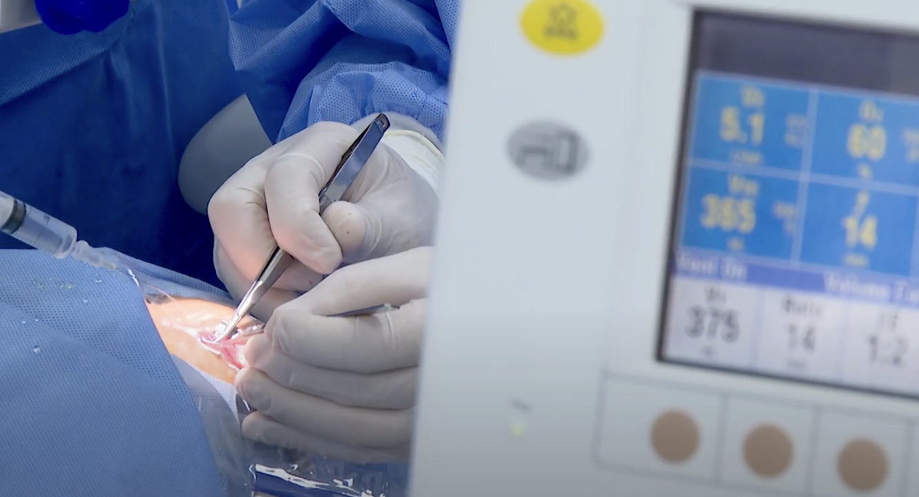 Doctor performs eye surgery for the patient. Photo: PHONG LAN