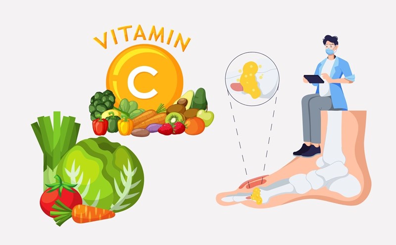 Discover the best foods for people with high uric acid. Graphics: Linh Dan