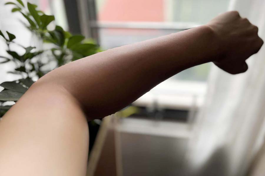 How to choose sunscreen and treat sunburn that men should know. Photo: Cat Tien