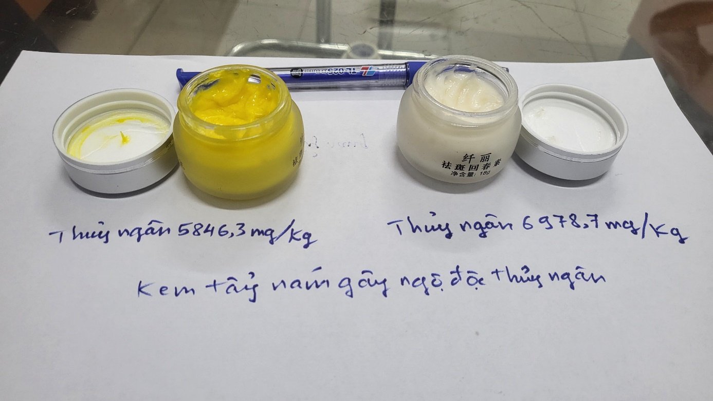 The "melasma exfoliation" set containing mercury has caused emergency patients at Bach Mai Hospital to be bought and sold via social networks. Photo: Provided by the doctor