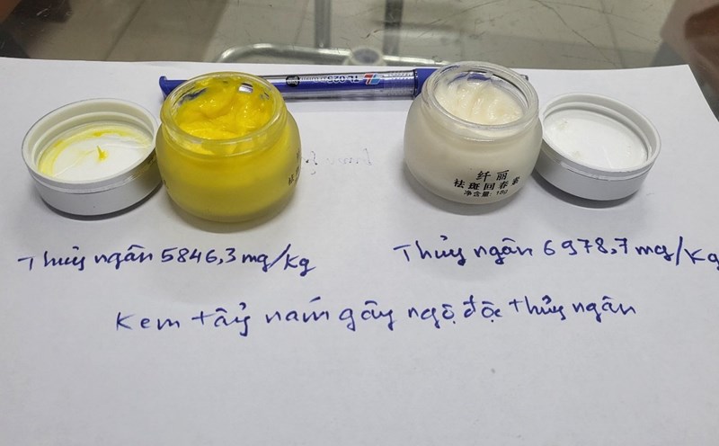 The "melasma exfoliation" set containing mercury has caused emergency patients at Bach Mai Hospital to be bought and sold via social networks. Photo: Provided by the doctor