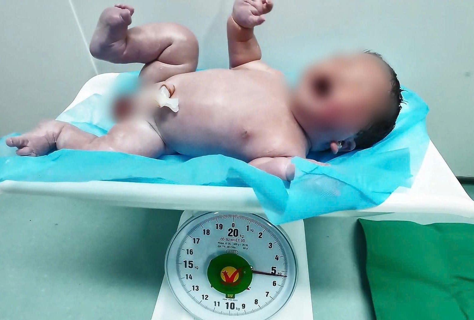 The baby boy was 5kgkg. Photo: Hai Phong Obstetrics and Gynecology Center