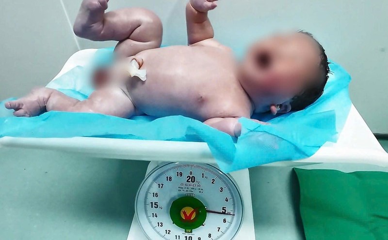 The baby boy was 5kgkg. Photo: Hai Phong Obstetrics and Gynecology Center
