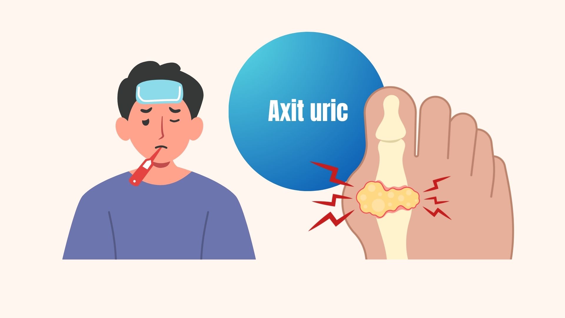 Signs of increased uric acid should not be ignored. Graphics: Linh Dan