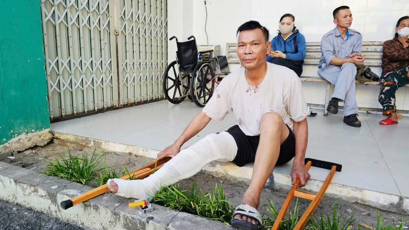 Anh Do Dinh Thieu (48 tuoi, tho xay, que Trieu Son – Thanh Hoa) bi gay chan va khau 5 mui tren dau, sau vu tai nan. Anh: Nguyen Hoang