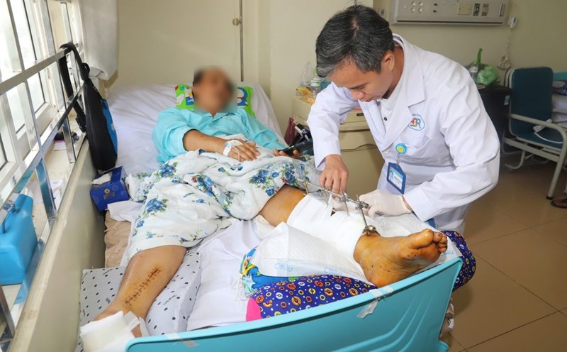Doctor Phan Van Tu treated the work accident with a severed leg. Photo: CDC provided