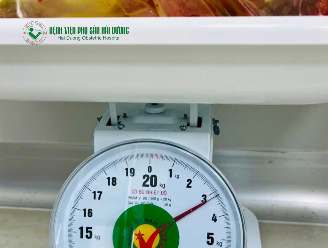 Successful surgery for a 3.2kg uterine fibroid tumor in Hai Duong. Photo: Hai Duong Obstetrics and Gynecology Hospital