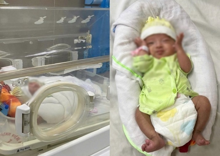 Los bebes prematuros sobreviven milagrosamente. Foto: BVCC