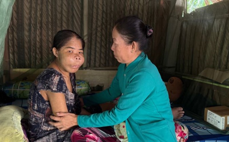 Ms. Thanh has severe kidney failure, is lying in one place, and has to ask her mother for care. Photo: Hoang Loc