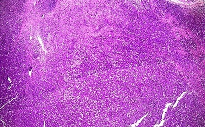 pathological tissue image for the result of the spread restructuring tissue. Photo: BVCC