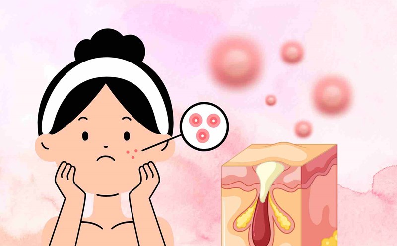 4 harmful effects of using cosmetics incorrectly causing dark skin, irritation, and acne