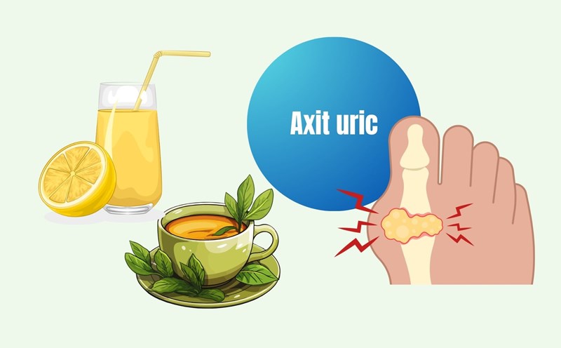 Drinks to reduce uric acid are easy to find. Graphics: Linh Dan