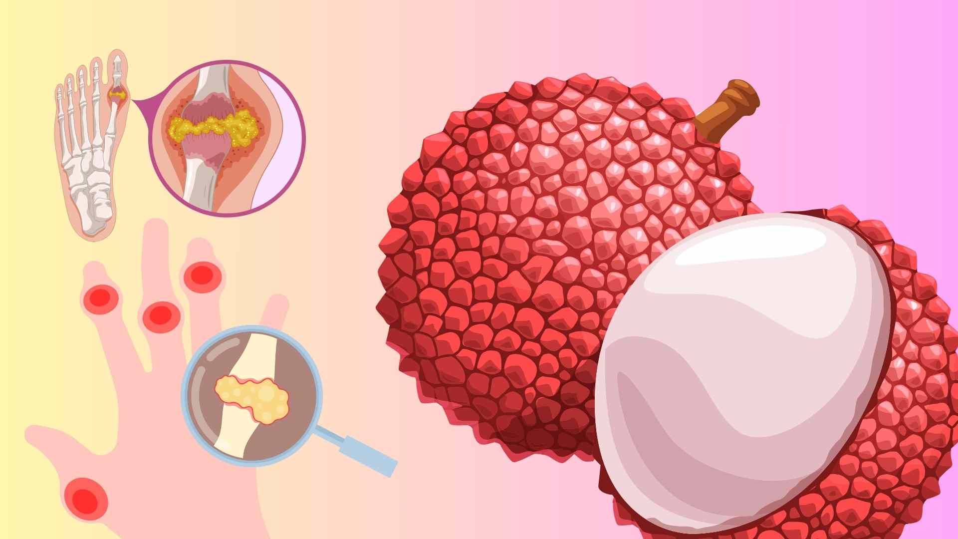 Unexpected benefits of seaweed for people with high uric acid. Graphics: Huyen Trang