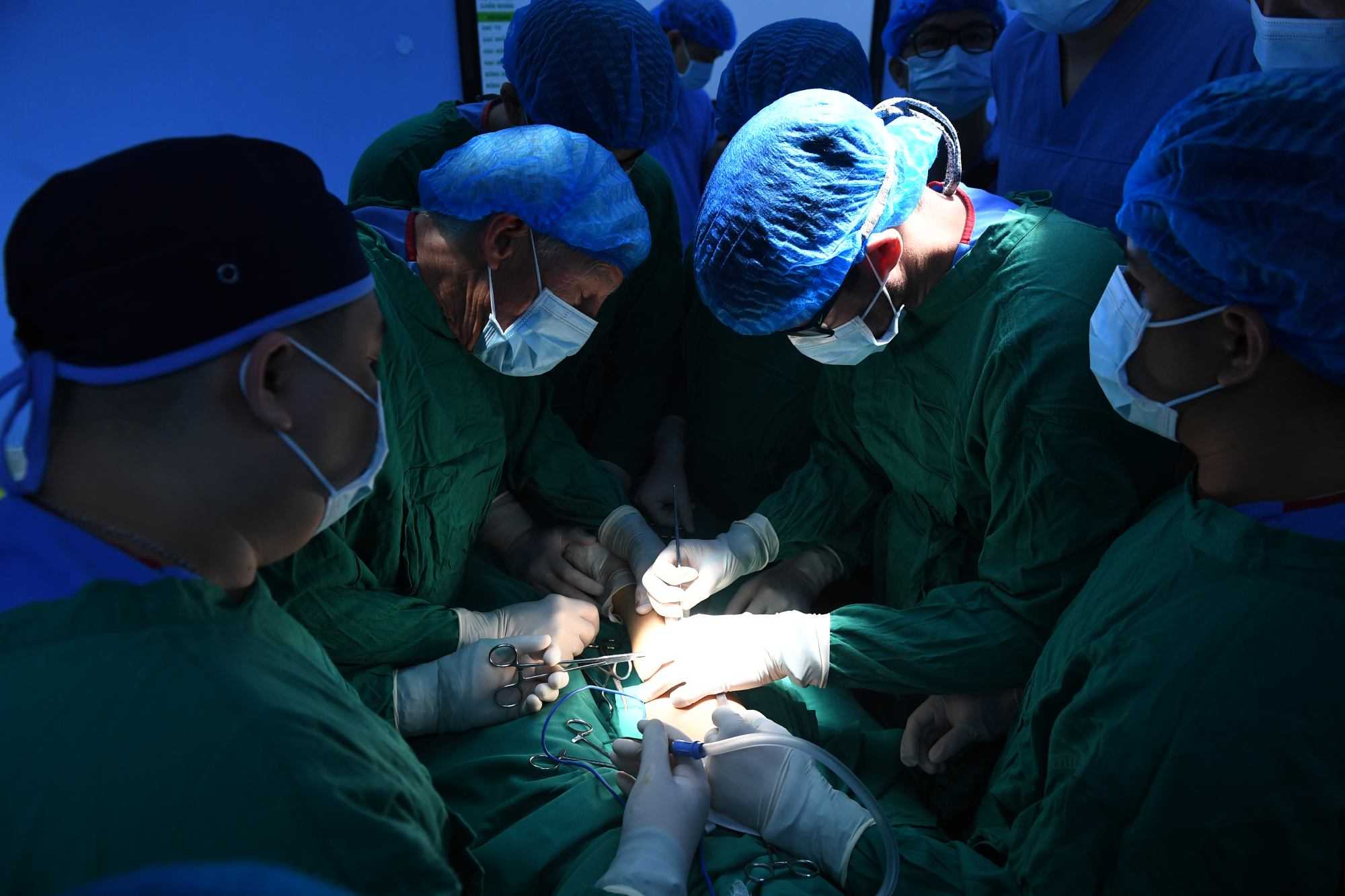  Nhung dua tre mang di tat bam sinh duoc cham tay vao hy vong nho chuong trinh phau thuat nhan dao. Anh: Lan Xuan