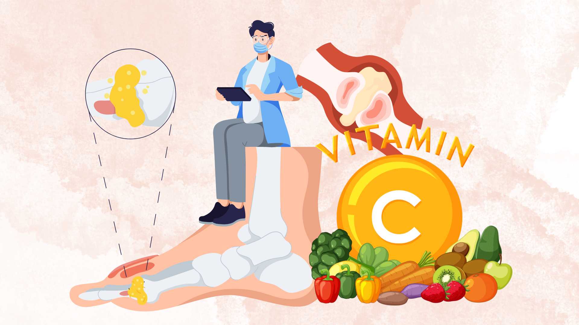 Control high uric acid with this familiar vitamin