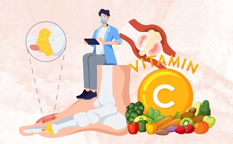 Control high uric acid with this familiar vitamin