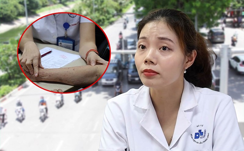 How to take care of the skin for 3 special subjects in hot weather