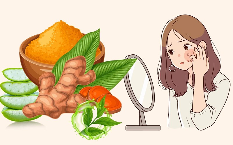 5 ways to treat acne at home in the summer. Graphics: Dinh Dinh