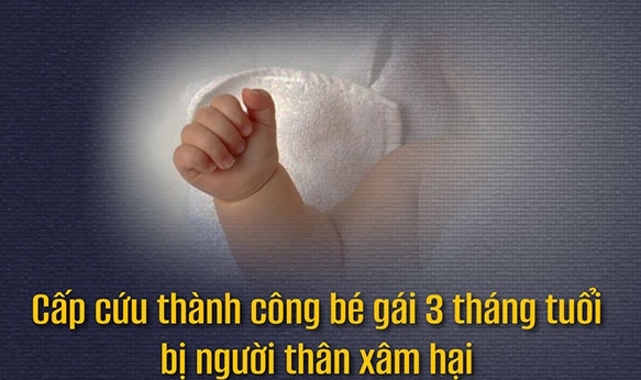 The National Children's Hospital has just successfully treated a 3-month-old girl who was abused by a relative. Photo: BVCC