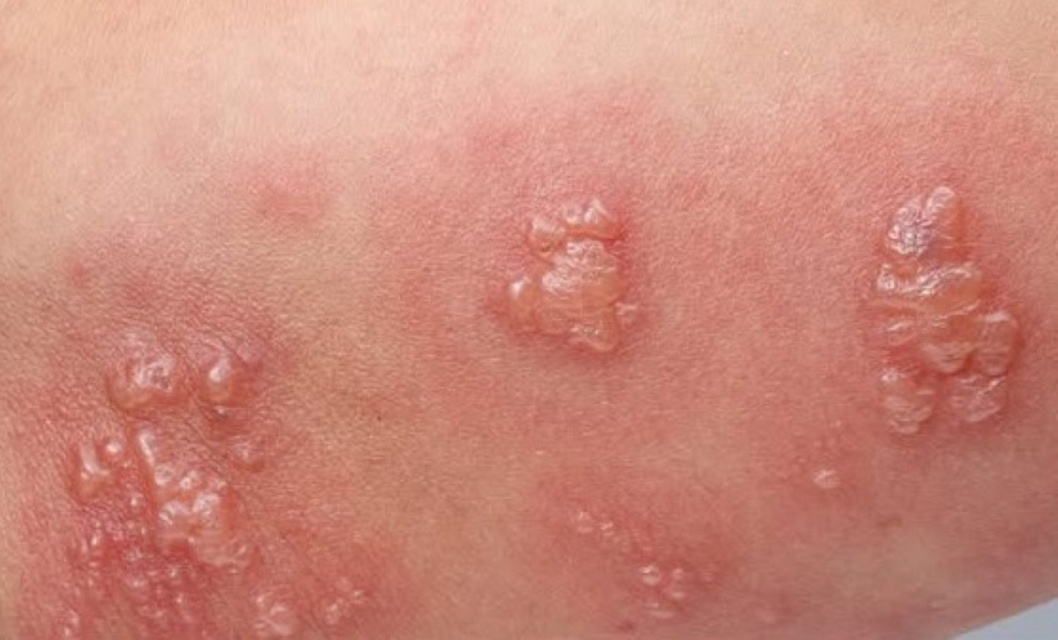 Neuronal zones. Photo: Provided by the hospital