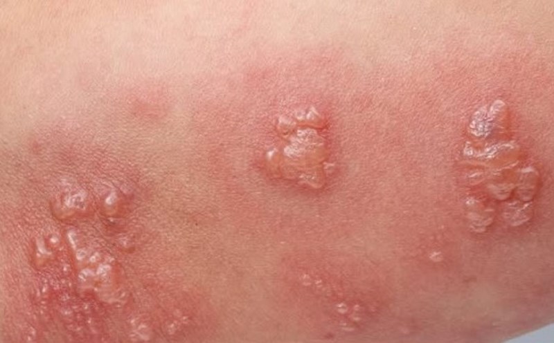 Neuronal zones. Photo: Provided by the hospital