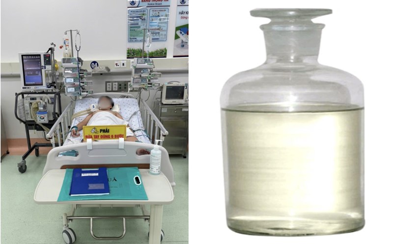 A healthy 13-year-old boy suddenly fell into a coma and suffered from severe respiratory failure due to inhaling the toxic gas styrene used to weld plastic. Photo: Provided by the Ho Chi Minh City Department of Health
