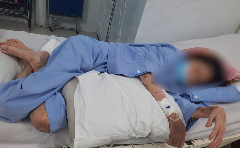 A young patient but had to undergo dialysis due to kidney failure. Photo: HUENG Son