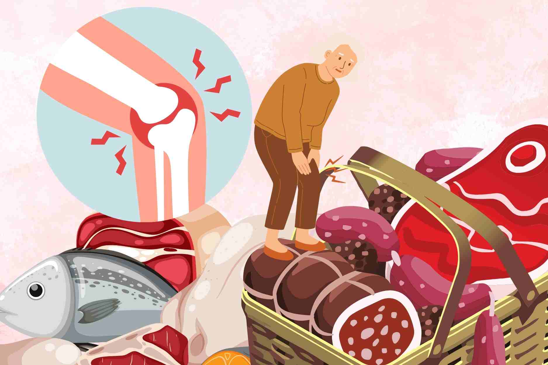 관절통 환자가 먹으면 안 되는 최악의 식품 3가지. 그래픽: Dinh Dinh