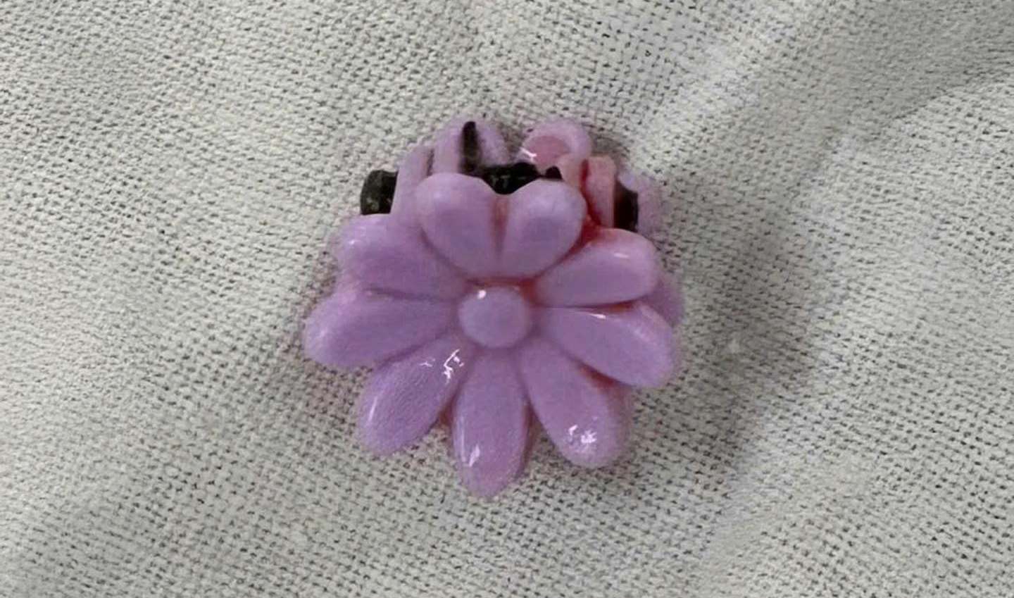 The foreign object was a hair clip taken by doctors from the girl's vagina. Photo: BVCC