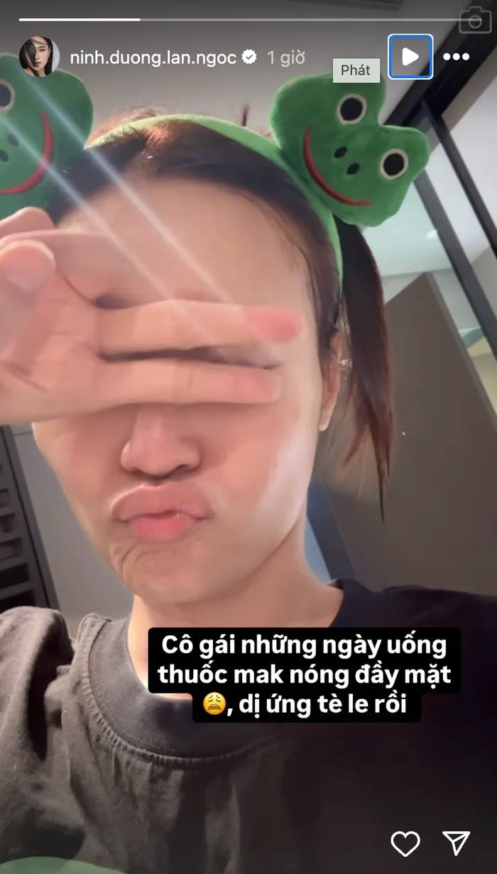 Ninh Duong Lan Ngoc bi di ung. Anh: Nghe si cung cap