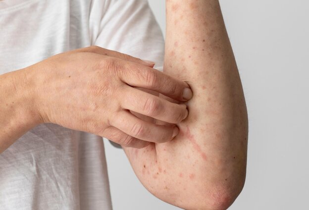 Signs that your liver is overloaded. Photo: Thuy Duong