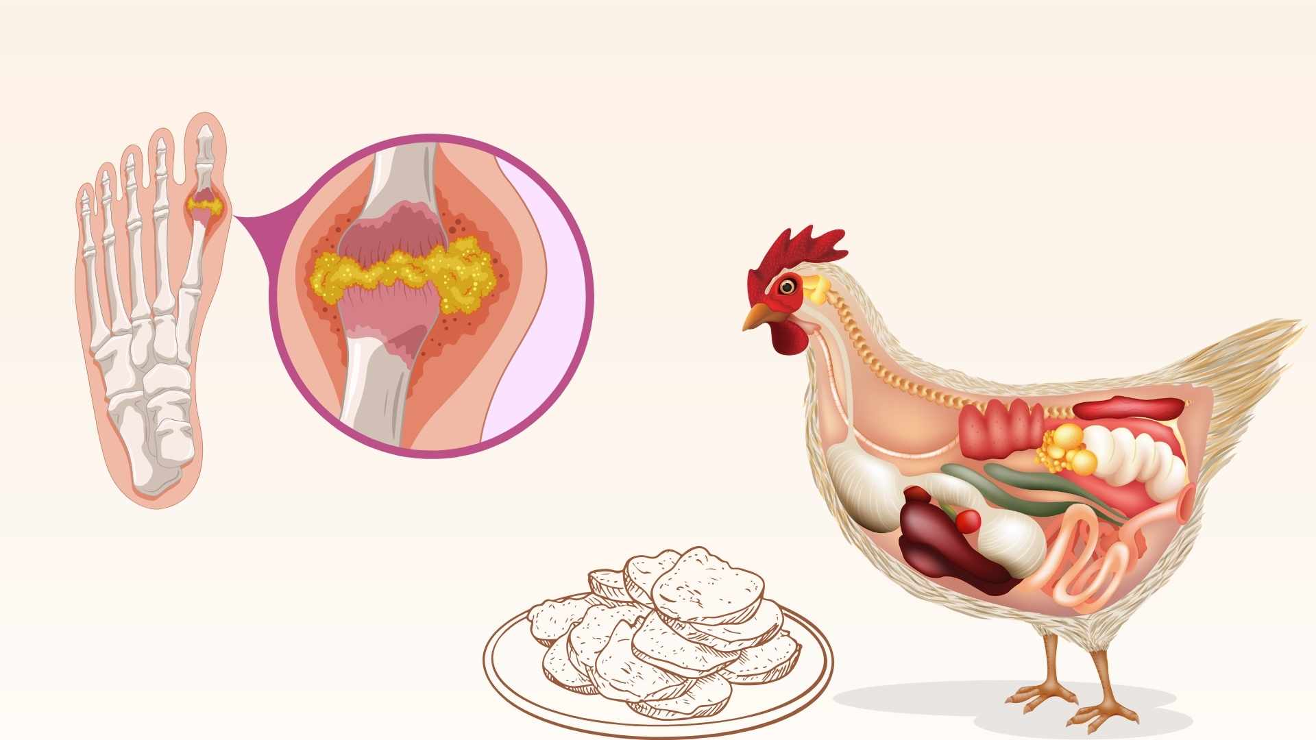 Reasons why people with high uric acid should not eat chicken breast. Graphics: Minh Chau