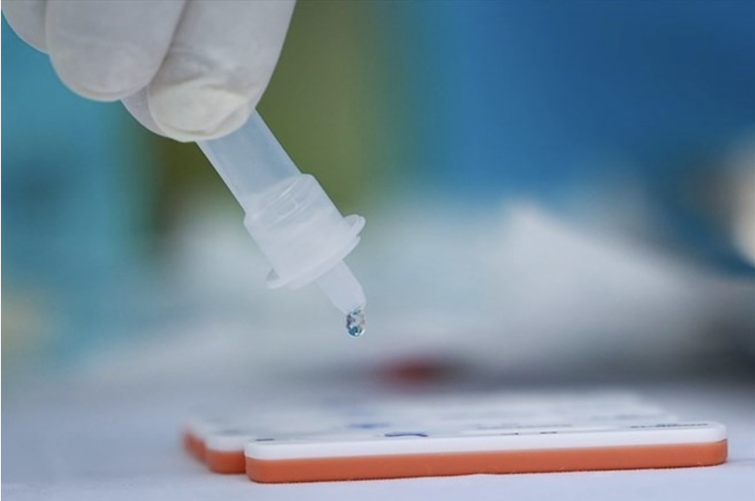 Pruebas Covid-19. Foto: Hai Nguyen