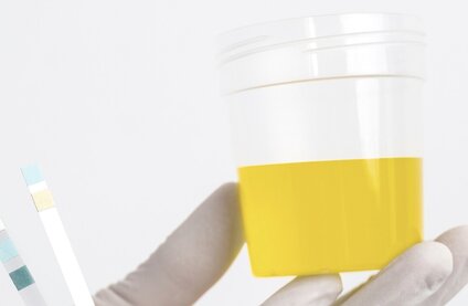 ¿La orina de la musica es un fenomeno fisiologico normal? Foto: thuy duong