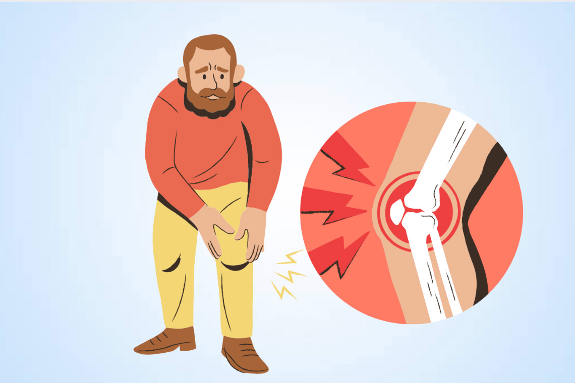 Experts' advice on controlling arthritis. Graphics: Thien Nhan